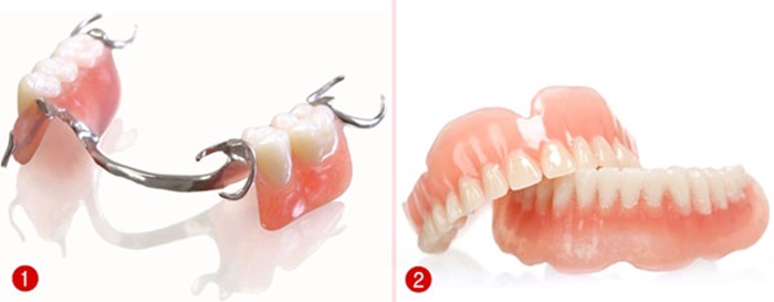 Phục hình tháo lắp là gì? Nên lựa chọn loại hàm tháo lắp nào tốt? 3