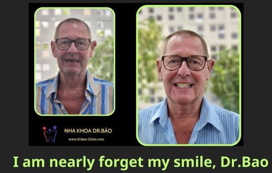 I nearly forget my smile Dr.Bao – A happy smile after dental treatment in Da Nang City